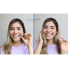 Load image into Gallery viewer, Secret Smile™ - Teeth Aligner | Set 1.0 - Secret Smile Co
